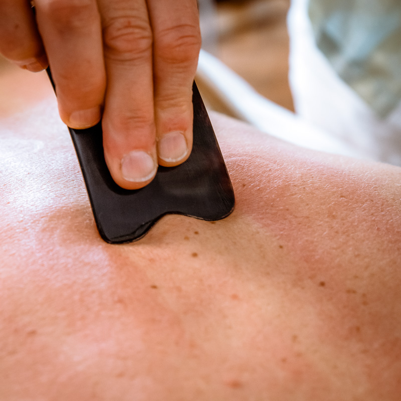 Read more about the article Gua Sha